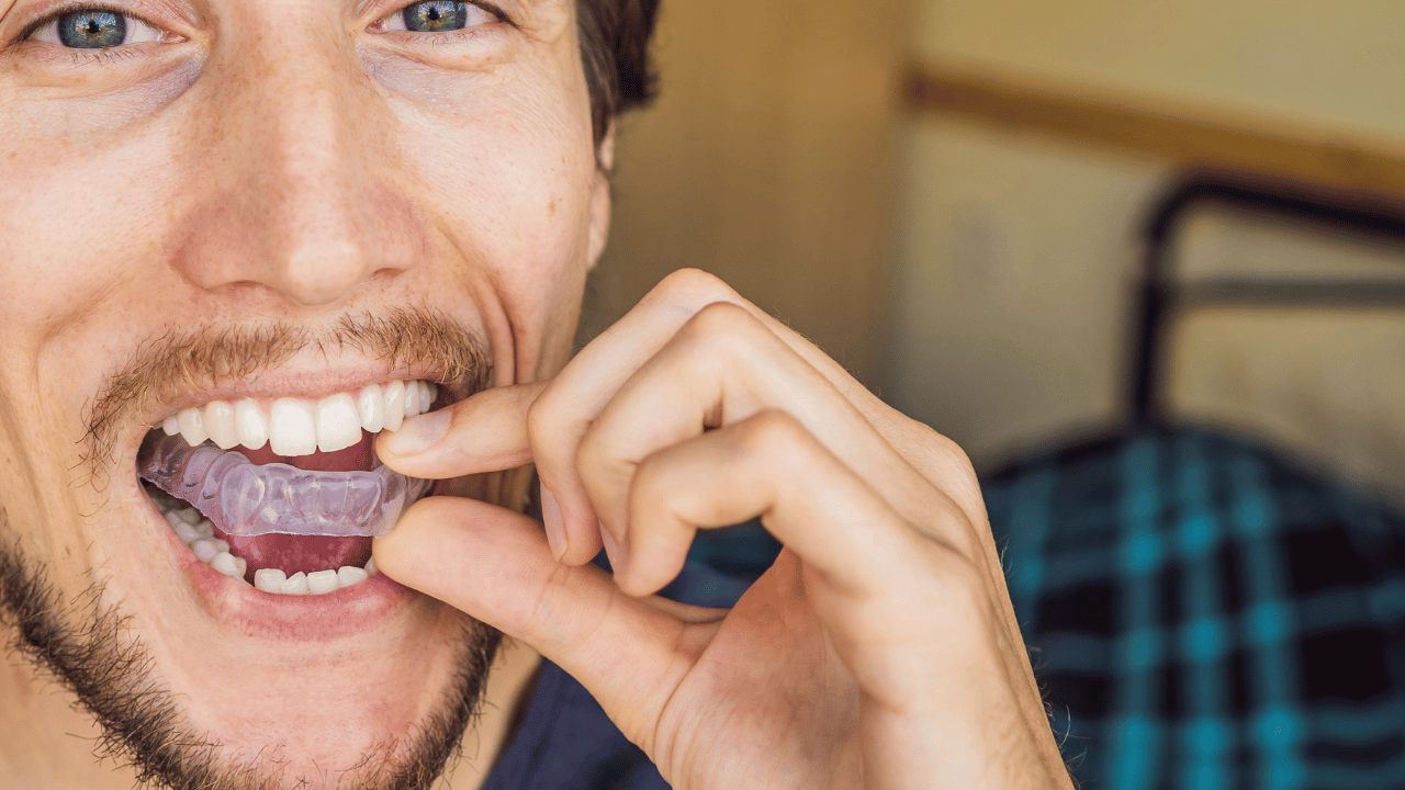 A close-up of a man placing a custom-fitted night guard in his mouth, used to prevent teeth grinding and manage TMJ disorder symptoms.